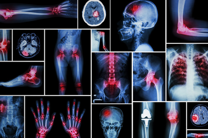 Aggiornamenti clinici in terapia del dolore